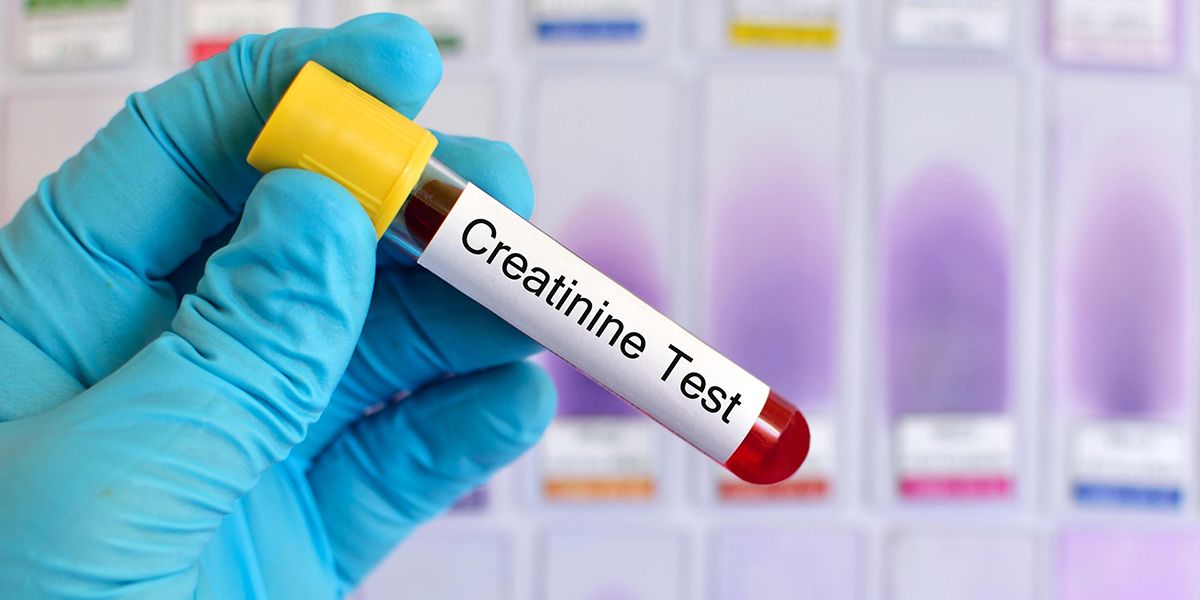 Comprendre l'impact d'une créatinine élevée chez les personnes âgées