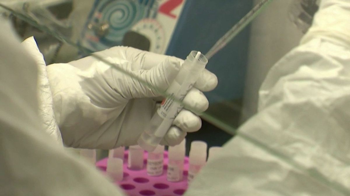 L'hantavirus en France : protocoles d'isolement pour les cas confirmés et contacts